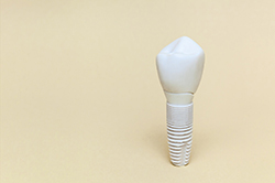 How dental implants work in Weyauwega