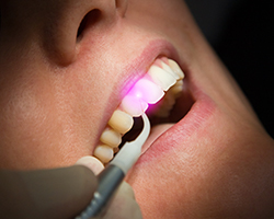 Woman receiving laser treatment