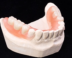 Model smile with partial denture