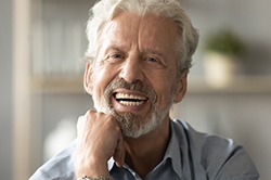 man smiling while wearing dentures 