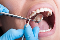 dentist looking inside patient’s mouth 