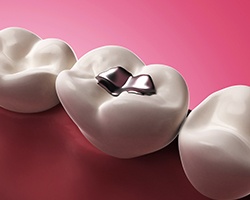 Animated tooth with metal filling