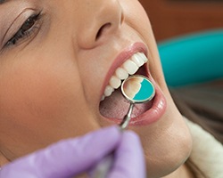 Closeup of patient receiving dental treatment