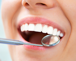 Patient receiving dental checkup