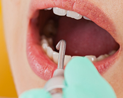 Closeup of patient receiving ozone treatment