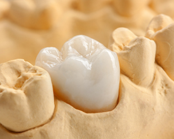 Model tooth with dental crown