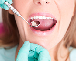 Closeup of patient receiving dental treatment