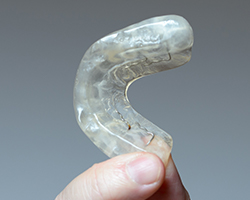 Hand holding an occlusal splint