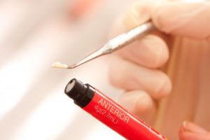 A dentist holding a capsule of composite resin.