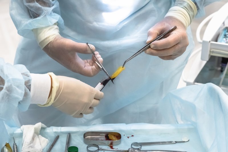 two dentists extract platelet rich fibrin from a tube to use on a patient’s surgical site