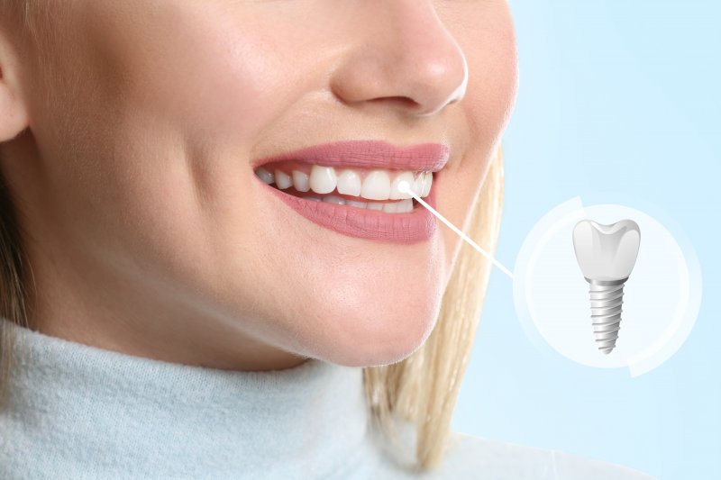 closeup of woman smiling with dental implant