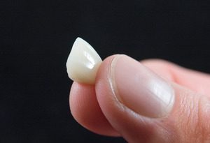 Holding a dental crown between fingers